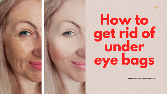 How to get rid of under eye bags