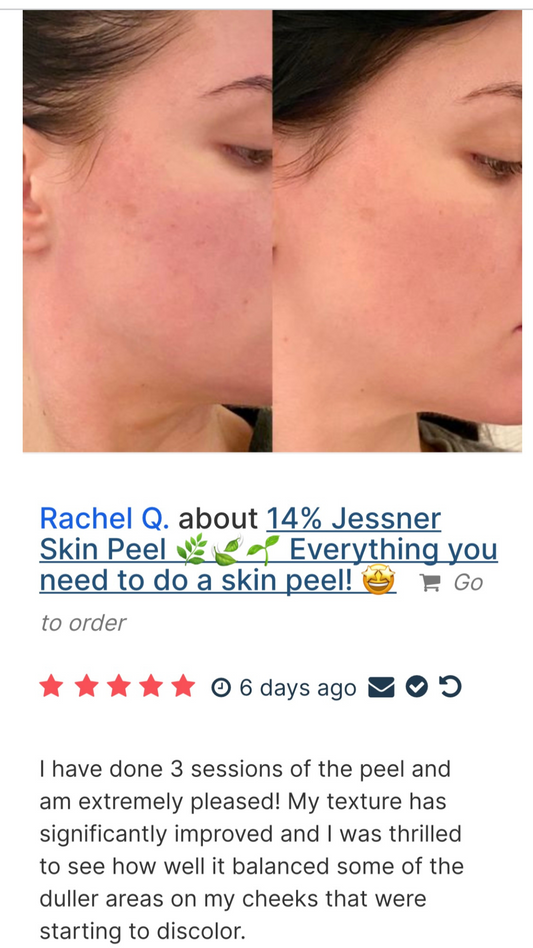 πΏ Jessner Skin Peel Bundle  πΏ Scroll β‘οΈ  to your right to see the "How To Video" π€© β‘οΈ