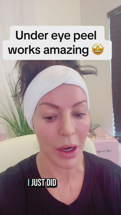 🌿 Jessner Skin Peel Bundle  🌿 🛑 USE CAUTION WHEN USING UNDER THE EYE SKIN 🛑